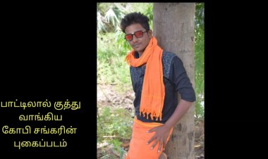 சரக்கு தள்ளாட்டத்தில் வாலிபருக்கு பாட்டில் குத்து!