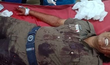 பெண் காவலருக்கு கத்தி வெட்டு! எடப்பாடி பழனிச்சாமி கண்டனம்!