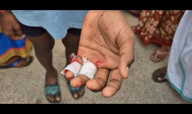 சிறுவன் கையை வெட்டிய முகமுடி நபர்!