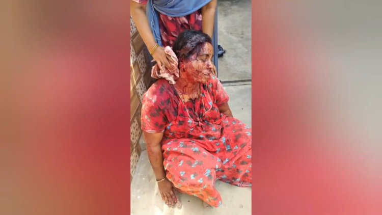 கிரைம் ஸ்பாட்டாக மாறிவரும் திருப்பத்தூர்! பட்டபகலில் பெண்ணுக்கு கத்திவெட்டு!